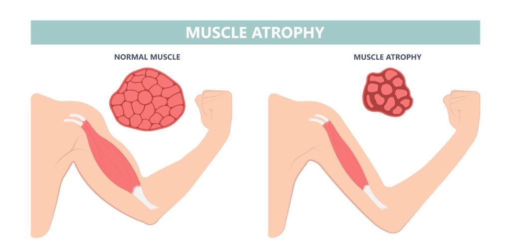 Muscle Damage Recovery
